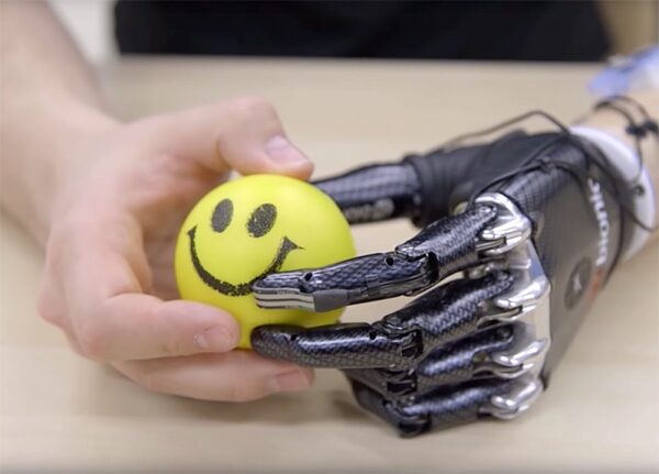 Будущее протезов: инновации Atom Limbs и доступность бионических решений